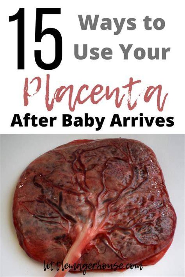 Can I keep my placenta after birth?