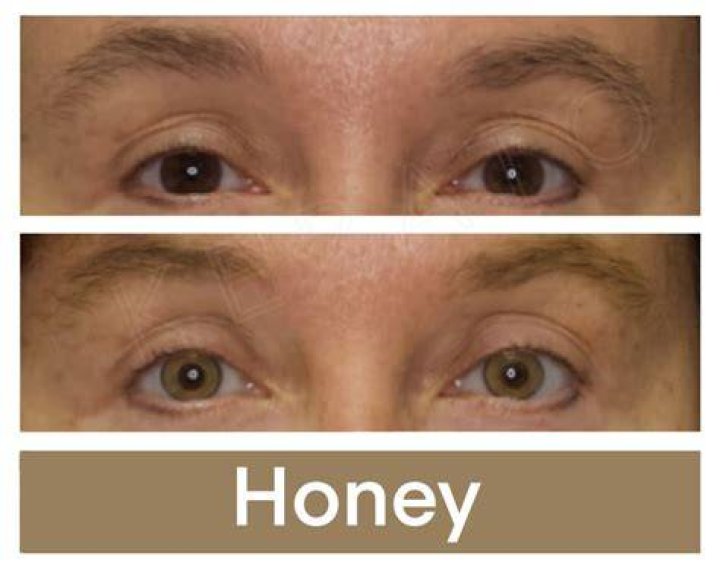 Does eating honey change eye color?