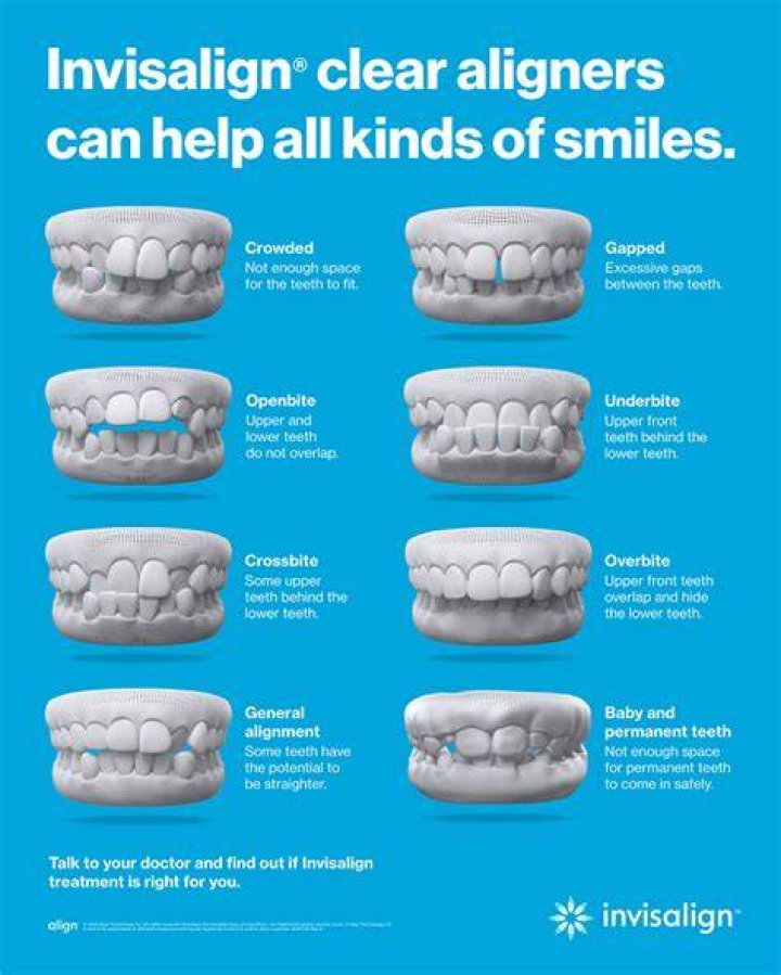 How old do u have to be to get an Invisalign?
