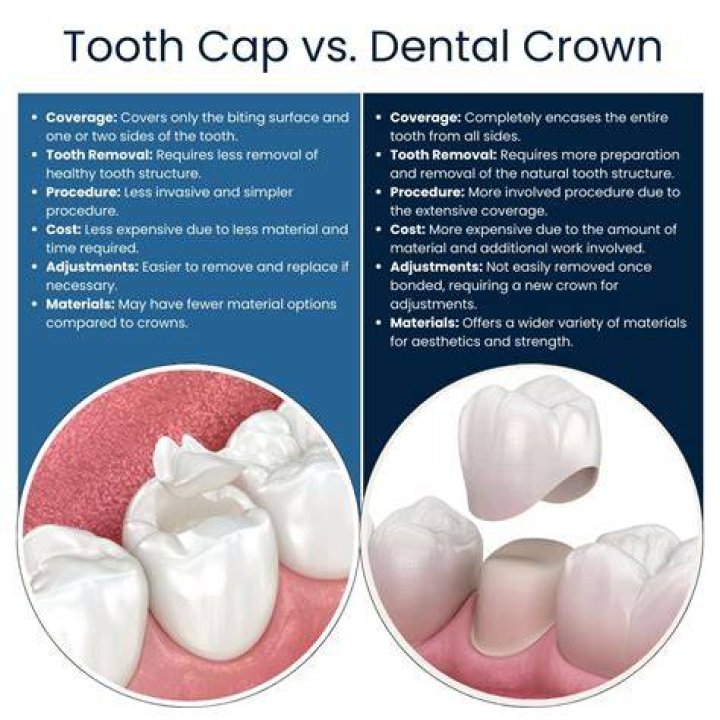 Which tooth cap is best?